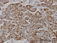H00003843-M01 - RanBP5 / Importin-5