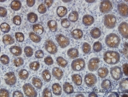 H00003851-M01 - Cytokeratin 4