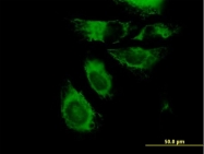 H00003855-B01P - Cytokeratin 7