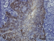 H00003872-M01 - Cytokeratin 17