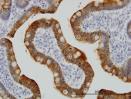 H00003872-M02 - Cytokeratin 17