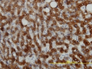 H00003875-M01 - Cytokeratin 18