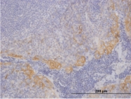 H00003880-B01P - Cytokeratin 19