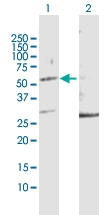 H00003882-D01P - Keratin-32 (KRT32)