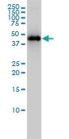 H00003884-M01 - Keratin-33B (KRT33B)