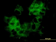 H00003884-M01 - Keratin-33B (KRT33B)