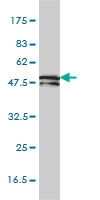 H00003887-M01 - Keratin-81 (KRT81)