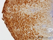 H00003887-M01 - Keratin-81 (KRT81)