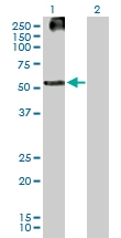 H00003889-B01P - Keratin-83 (KRT83)