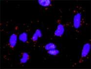 H00003911-D01P - Laminin alpha 5