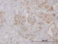 H00003934-B01P - Lipocalin-2
