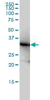 H00003945-M01 - LDHB
