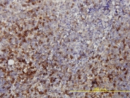 H00003945-M01 - LDHB