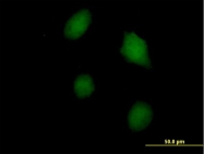 H00003958-B01P - Galectin-3