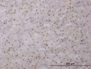 H00003975-M11 - LHX1