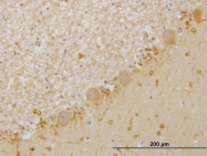 H00003984-M05 - LIMK1