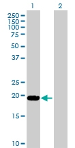 H00004049-D01P - TNF-beta / Lymphotoxin-alpha