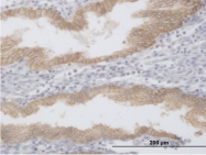 H00004072-B01P - CD326 / EPCAM / TACSTD1