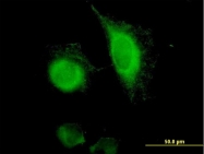 H00004072-B02 - CD326 / EPCAM / TACSTD1