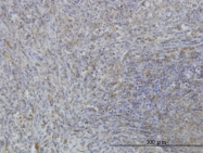 H00004082-M06 - MARCKS