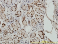H00004086-M02 - SMAD1