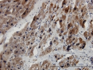H00004087-M04 - SMAD2
