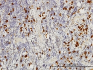 H00004088-M01 - SMAD3