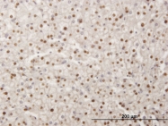 H00004091-M01 - SMAD6