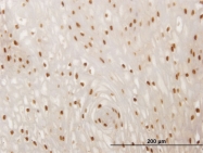 H00004091-M02 - SMAD6