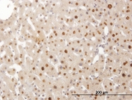 H00004091-M09 - SMAD6