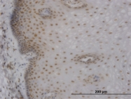 H00004154-M02 - MBNL1