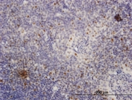 H00004173-B01 - MCM4