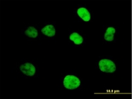 H00004173-B01 - MCM4