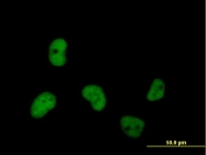 H00004176-B01 - MCM7