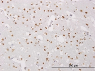 H00004204-M03 - MeCP2