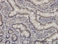 H00004205-M01 - MEF2A