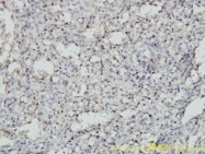 H00004212-M01 - MEIS2