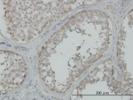 H00004216-M02 - MAP3K4