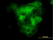 H00004217-M03 - MEKK5 / ASK1