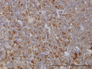 H00004218-M02 - RAB8A