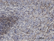 H00004296-M02 - MAP3K11