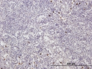 H00004332-B01P - MNDA