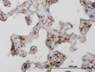 H00004360-M02 - CD206 / MRC1