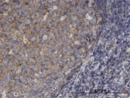 H00004478-M13 - Moesin
