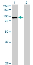 H00004485-D01P - Macrophage stimulatory protein
