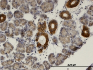H00004598-M02 - Mevalonate kinase