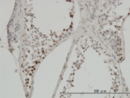 H00004609-M02 - c-Myc