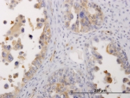H00004627-M06 - Myosin-9 / MYH9