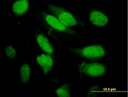 H00004735-B01P - Septin-2