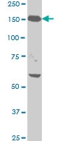 H00004744-M01 - Neurofilament H (200 kD)
